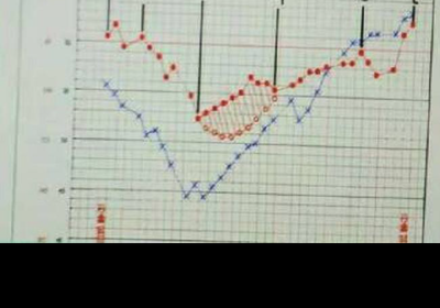 电脑体温单说明