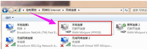 电脑本地连接网络